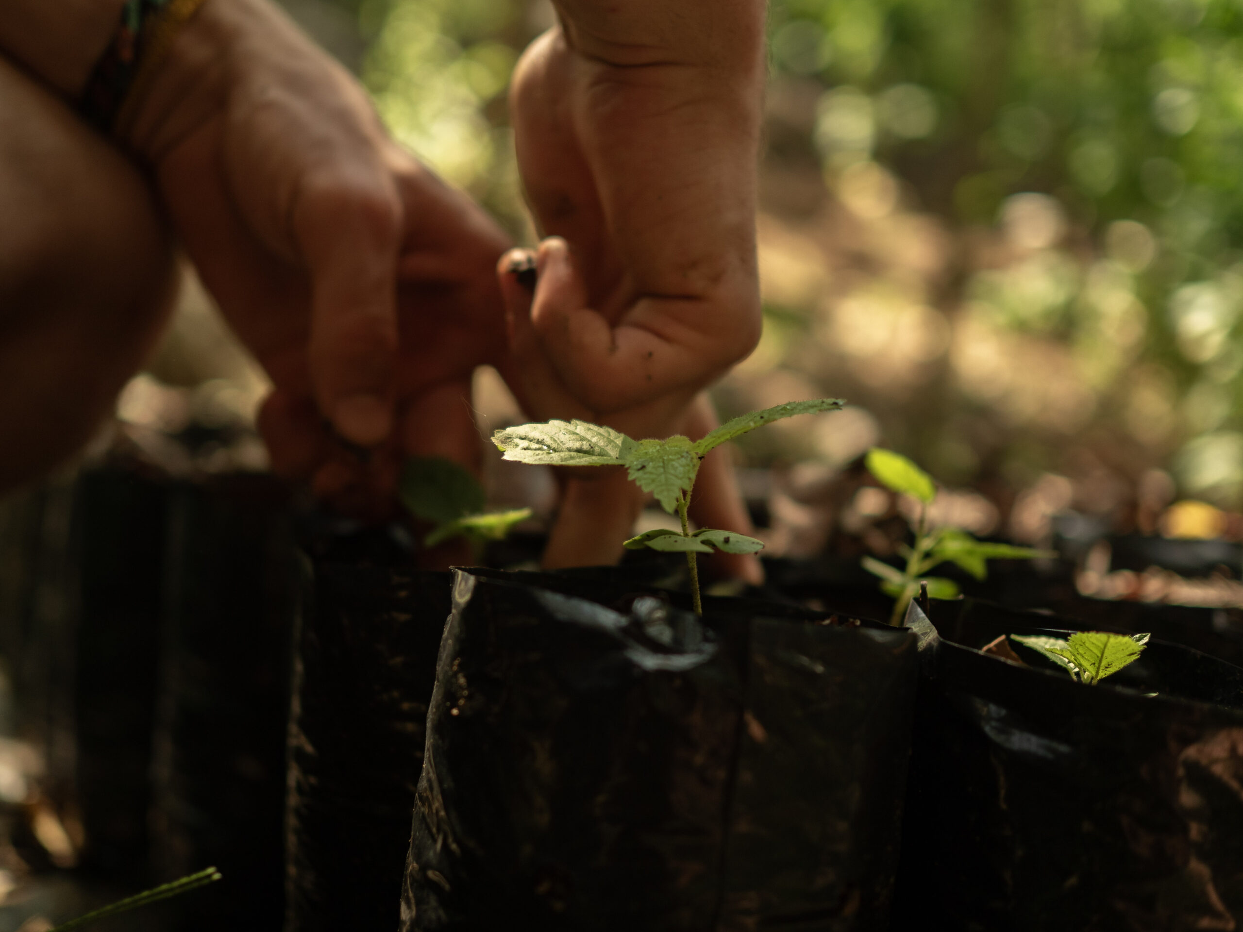 manos en transplante